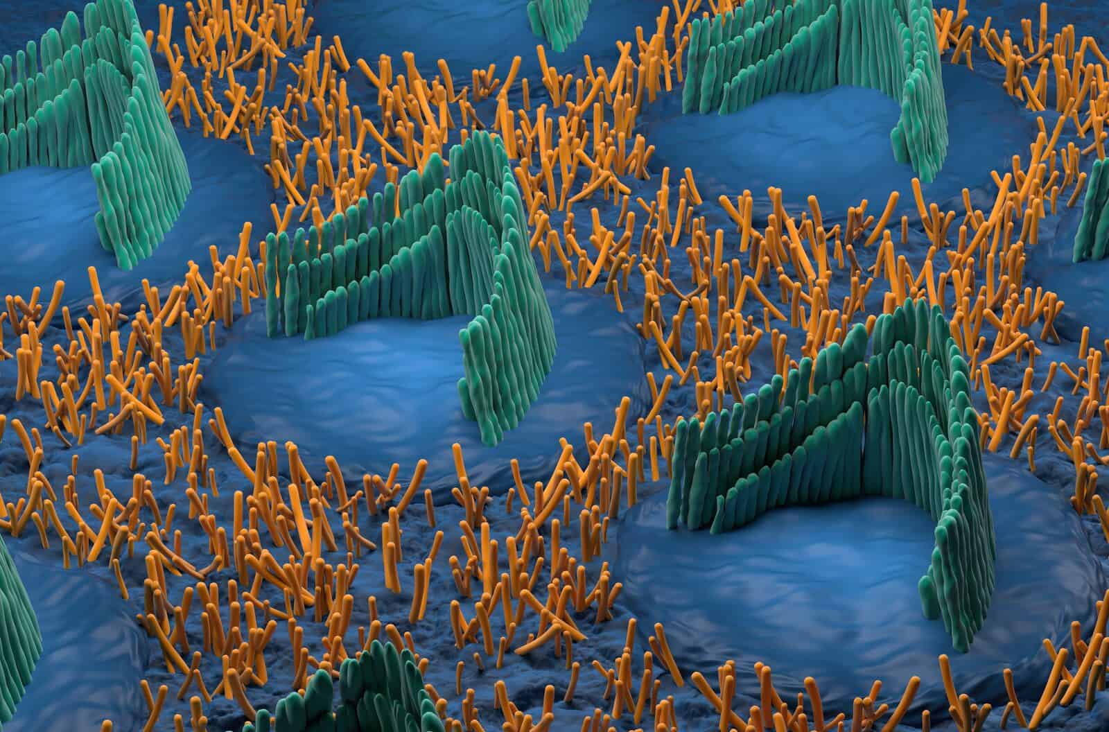 Medical illustration of cochlear hair cells and sudden sensorineural hearing loss